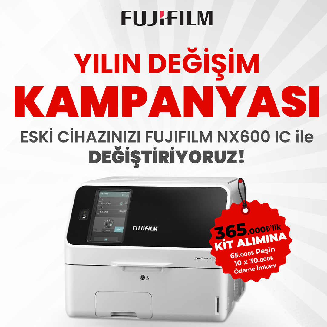 Yılın Değişim Kampanyası